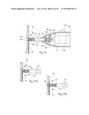 Method for Attaching a Prosthesis to Soft Tissue diagram and image