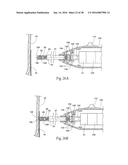 Method for Attaching a Prosthesis to Soft Tissue diagram and image