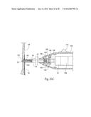 Method for Attaching a Prosthesis to Soft Tissue diagram and image