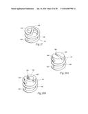 Method for Attaching a Prosthesis to Soft Tissue diagram and image