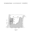 Method for Attaching a Prosthesis to Soft Tissue diagram and image