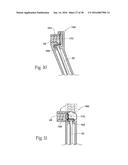 Method for Attaching a Prosthesis to Soft Tissue diagram and image