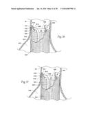 Method for Attaching a Prosthesis to Soft Tissue diagram and image