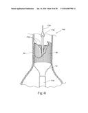 Method for Attaching a Prosthesis to Soft Tissue diagram and image