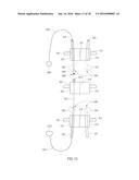 PERCUTANEOUS SYSTEM AND METHODS FOR ENHANCED EPIDURAL ACCESS FOR SPINE     SURGERY diagram and image