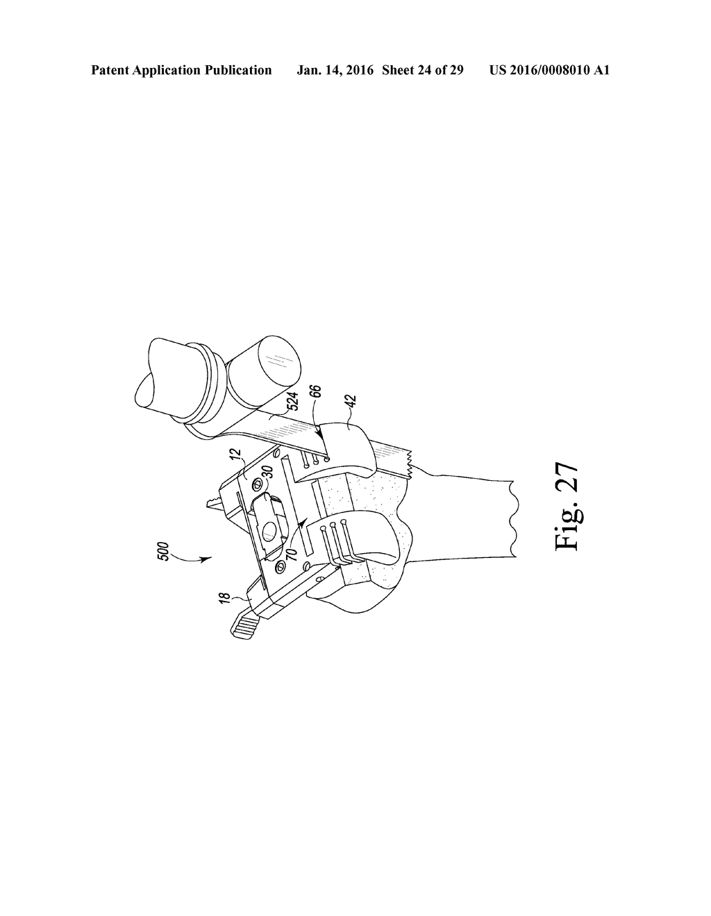 METHOD OF ASSEMBLING AND POSITIONING A FEMORAL ORTHOPAEDIC SURGICAL     INSTRUMENT - diagram, schematic, and image 25