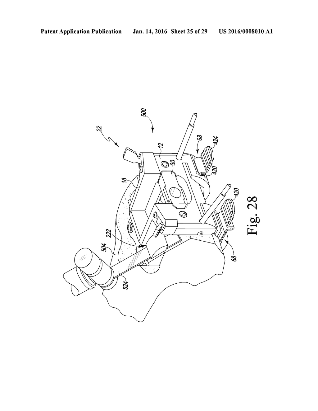 METHOD OF ASSEMBLING AND POSITIONING A FEMORAL ORTHOPAEDIC SURGICAL     INSTRUMENT - diagram, schematic, and image 26