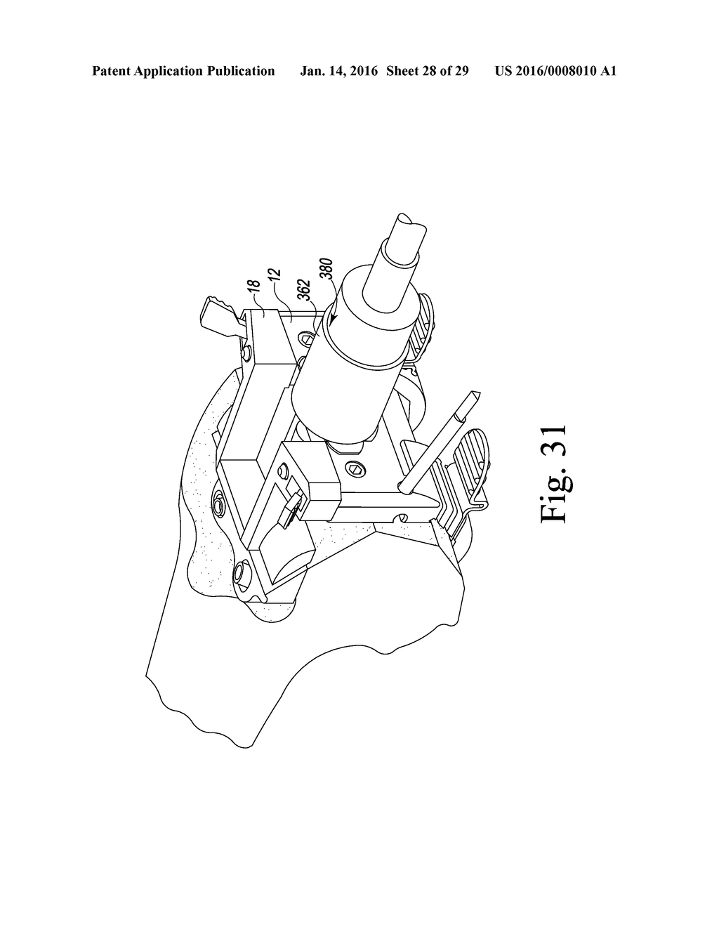 METHOD OF ASSEMBLING AND POSITIONING A FEMORAL ORTHOPAEDIC SURGICAL     INSTRUMENT - diagram, schematic, and image 29