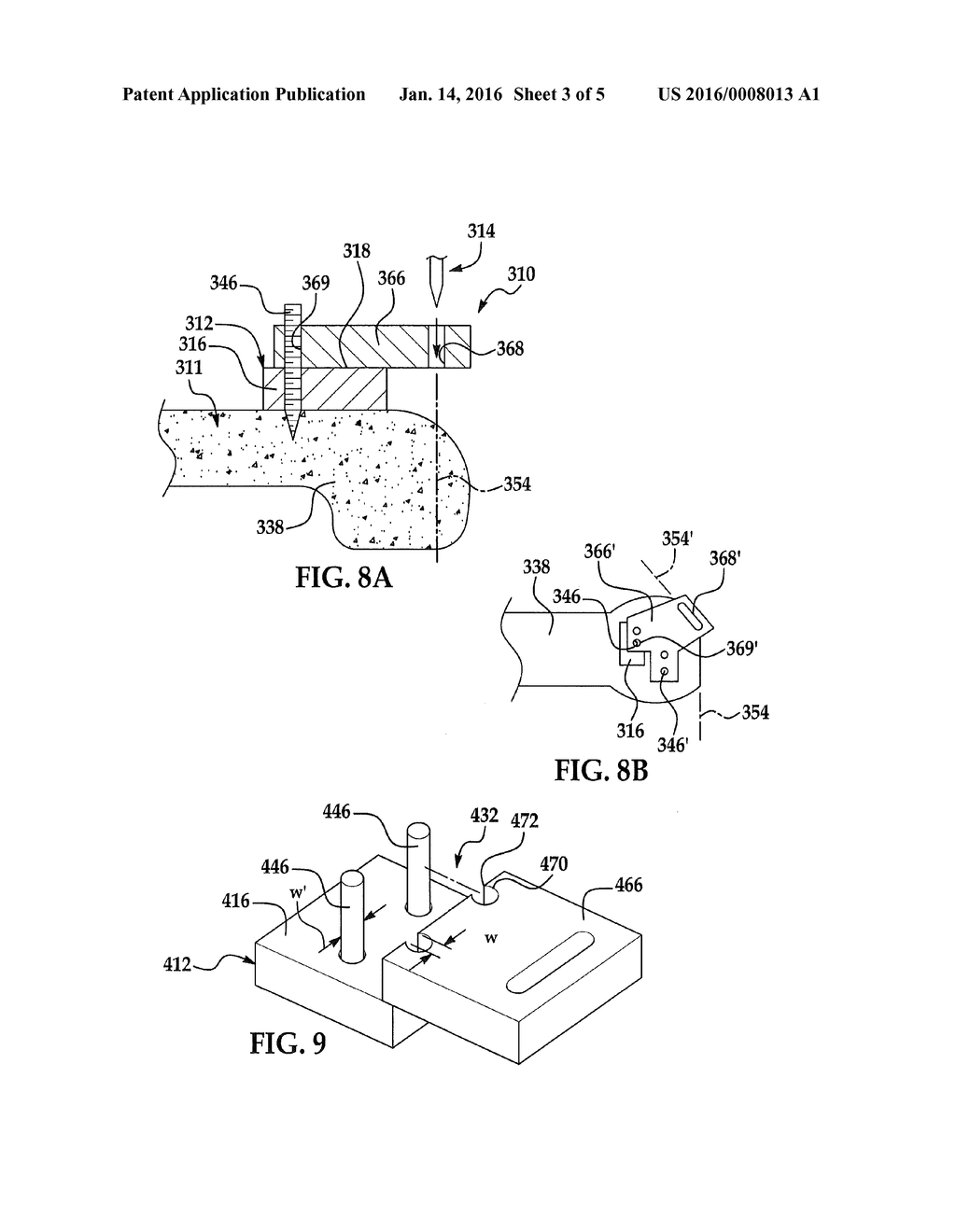 PATIENT SPECIFIC ALIGNMENT GUIDE WITH CUTTING SURFACE AND LASER INDICATOR - diagram, schematic, and image 04