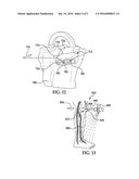 PATIENT SPECIFIC ALIGNMENT GUIDE WITH CUTTING SURFACE AND LASER INDICATOR diagram and image