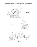 Blood Vessel Treatment with Pressure Shock Waves diagram and image