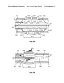 Blood Vessel Treatment with Pressure Shock Waves diagram and image