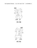 Blood Vessel Treatment with Pressure Shock Waves diagram and image