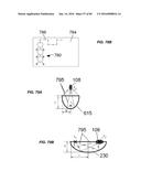 Blood Vessel Treatment with Pressure Shock Waves diagram and image