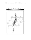 Blood Vessel Treatment with Pressure Shock Waves diagram and image