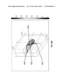 Blood Vessel Treatment with Pressure Shock Waves diagram and image