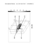 Blood Vessel Treatment with Pressure Shock Waves diagram and image