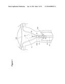 UTERINE LAVAGE FOR EMBRYO RETRIEVAL diagram and image