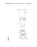 UTERINE LAVAGE FOR EMBRYO RETRIEVAL diagram and image