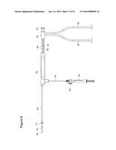 UTERINE LAVAGE FOR EMBRYO RETRIEVAL diagram and image