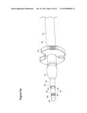 UTERINE LAVAGE FOR EMBRYO RETRIEVAL diagram and image