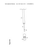 UTERINE LAVAGE FOR EMBRYO RETRIEVAL diagram and image