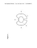 UTERINE LAVAGE FOR EMBRYO RETRIEVAL diagram and image