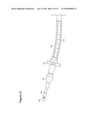 UTERINE LAVAGE FOR EMBRYO RETRIEVAL diagram and image