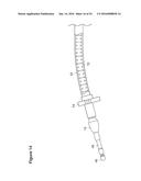 UTERINE LAVAGE FOR EMBRYO RETRIEVAL diagram and image