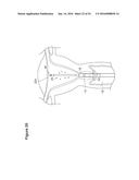 UTERINE LAVAGE FOR EMBRYO RETRIEVAL diagram and image