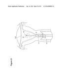 UTERINE LAVAGE FOR EMBRYO RETRIEVAL diagram and image