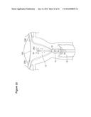 UTERINE LAVAGE FOR EMBRYO RETRIEVAL diagram and image