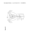 UTERINE LAVAGE FOR EMBRYO RETRIEVAL diagram and image