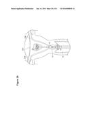 UTERINE LAVAGE FOR EMBRYO RETRIEVAL diagram and image