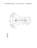 UTERINE LAVAGE FOR EMBRYO RETRIEVAL diagram and image