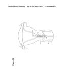 UTERINE LAVAGE FOR EMBRYO RETRIEVAL diagram and image