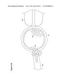 UTERINE LAVAGE FOR EMBRYO RETRIEVAL diagram and image