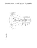 UTERINE LAVAGE FOR EMBRYO RETRIEVAL diagram and image