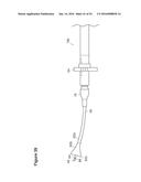 UTERINE LAVAGE FOR EMBRYO RETRIEVAL diagram and image