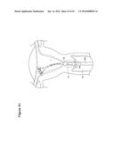 UTERINE LAVAGE FOR EMBRYO RETRIEVAL diagram and image