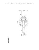 UTERINE LAVAGE FOR EMBRYO RETRIEVAL diagram and image