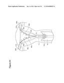 UTERINE LAVAGE FOR EMBRYO RETRIEVAL diagram and image