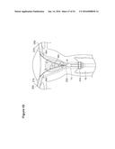 UTERINE LAVAGE FOR EMBRYO RETRIEVAL diagram and image