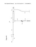 UTERINE LAVAGE FOR EMBRYO RETRIEVAL diagram and image