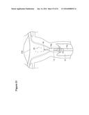 UTERINE LAVAGE FOR EMBRYO RETRIEVAL diagram and image