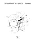 SYSTEM AND METHOD FOR STABILIZING A POSTERIOR FUSION OVER MOTION SEGMENTS diagram and image