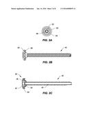 SYSTEM AND METHOD FOR STABILIZING A POSTERIOR FUSION OVER MOTION SEGMENTS diagram and image