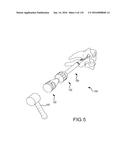 FACET JOINT IMPLANTS AND DELIVERY TOOLS diagram and image