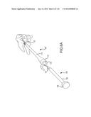 FACET JOINT IMPLANTS AND DELIVERY TOOLS diagram and image