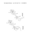 FACET JOINT IMPLANTS AND DELIVERY TOOLS diagram and image